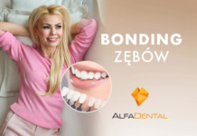 bonding zebow alfa dental olsztyn