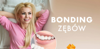 bonding zebow alfa dental olsztyn